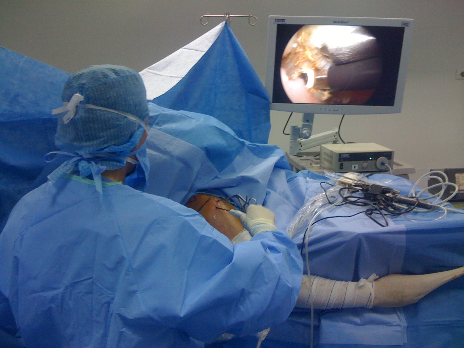 Artroskopi Supi, Dr. Arian Celaj